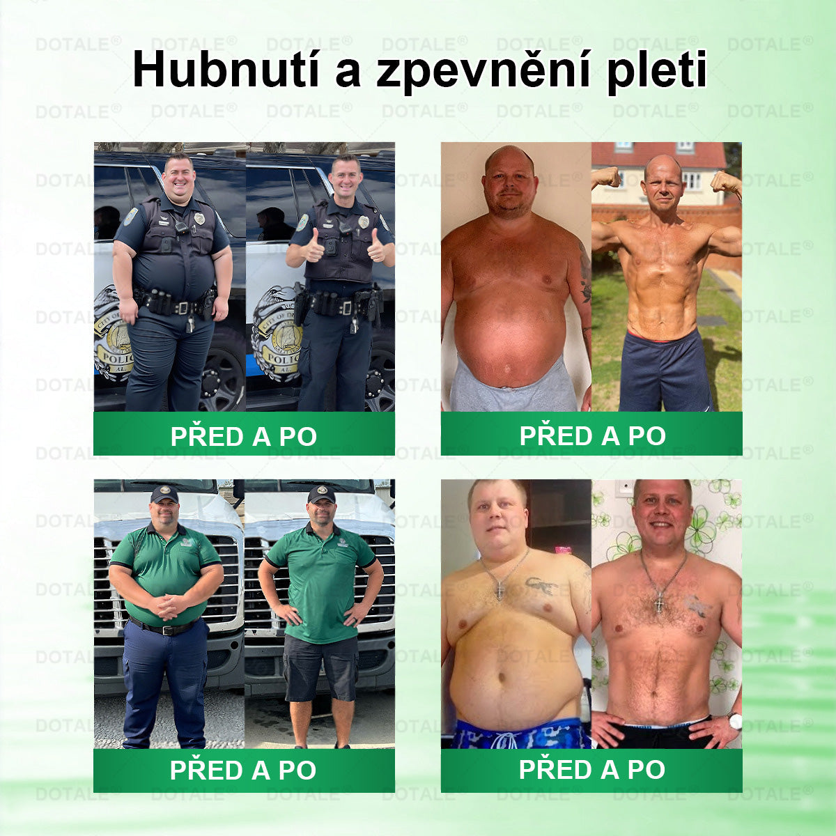 𝐆𝐞𝐧𝐚𝐲𝐮® metabolická nano mikrojehličková náplast 🧑‍⚕️ (Pouze jednou denně, viditelné výsledky již do 7 dnů!) ✅ Formule Berberin + Moringa, ideální při nadváze, nedokonalostech pokožky, diabetu, spánkové apnoe a kloubních potížích 💥💥