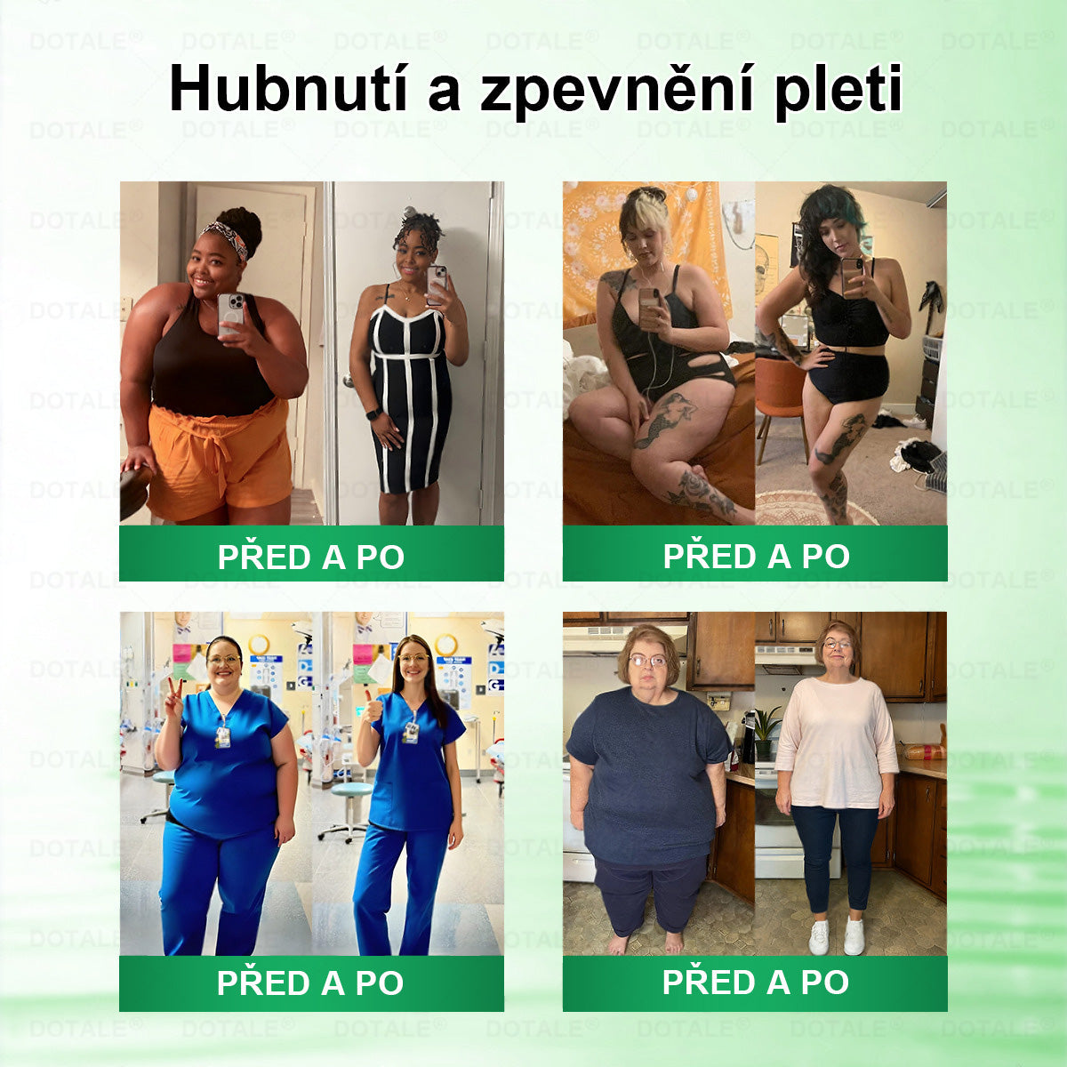 𝐆𝐞𝐧𝐚𝐲𝐮® metabolická nano mikrojehličková náplast 🧑‍⚕️ (Pouze jednou denně, viditelné výsledky již do 7 dnů!) ✅ Formule Berberin + Moringa, ideální při nadváze, nedokonalostech pokožky, diabetu, spánkové apnoe a kloubních potížích 💥💥