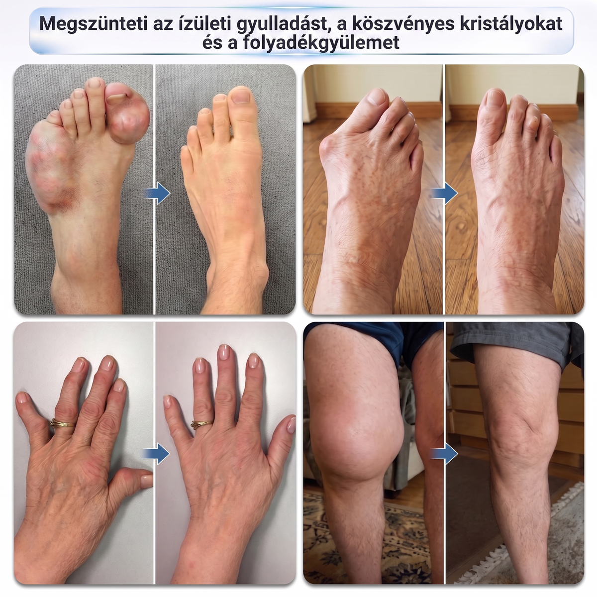 OFICIÁLNÍ E-SHOP | DR.HONOR® Mikrojehličkový roll-on 0,05 mm s rychlým účinkem pro úlevu od bolesti kloubů a kostí 🦴